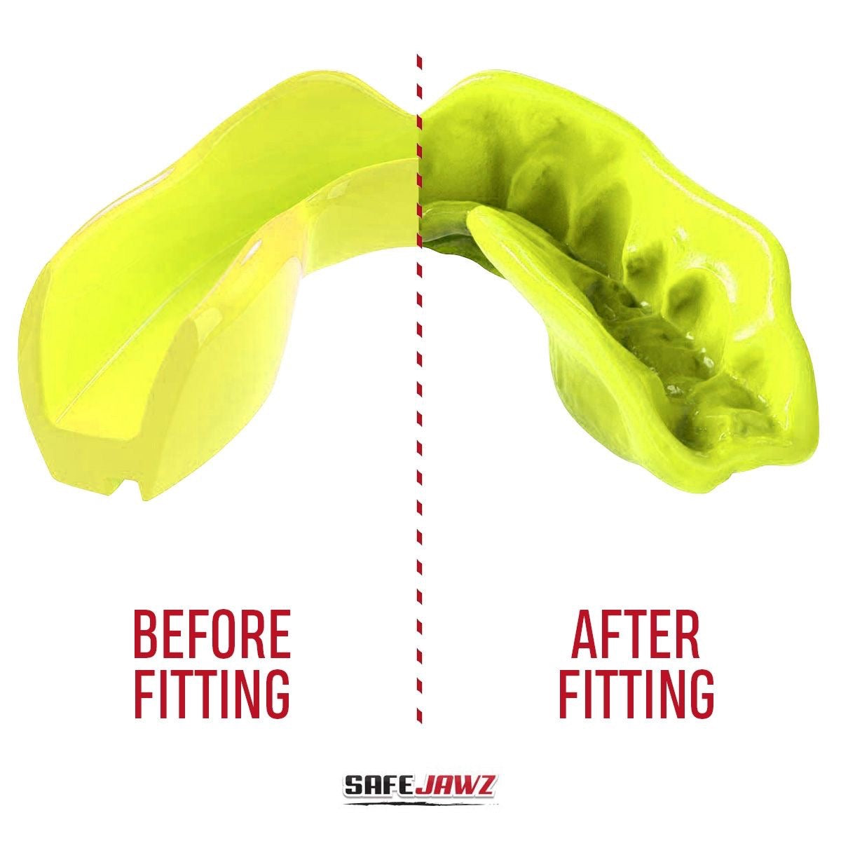 Safejawz gebitsbeschermer Intro Series – groen