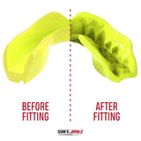 Safejawz gebitsbeschermer Intro Series – groen